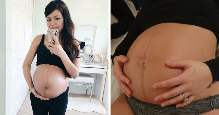 Everyone’s Body Is Different During Pregnancy And 30 Women Decided To Celebrate It By Sharing Pics Of Theirs