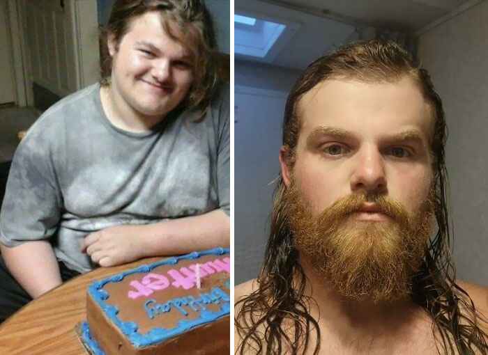 Me At 15 And Me About To Turn 22. Lost About 100 Lbs Since Then