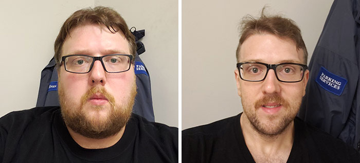 10.5 Months Of Face Gains. Start Weight 356 Lbs, Current Weight 197 Lbs. Couldn't Wait For The 1 Year Anniversary