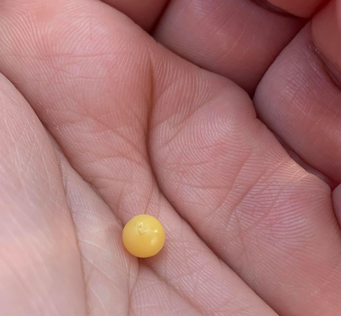 This Small Plastic Ball Was Found Dislodged In My Ear. Any Ideas?