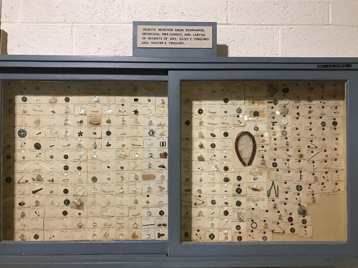 My Hometown's Museum Has A Collection Of Objects Doctors Have Removed From Patients' Throats And Lungs