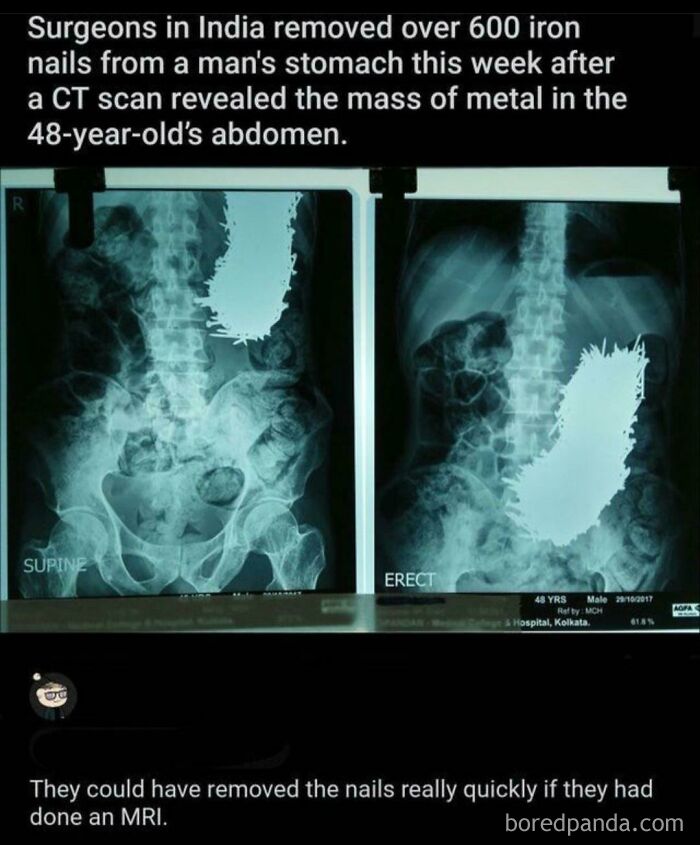 Cursed MRI
