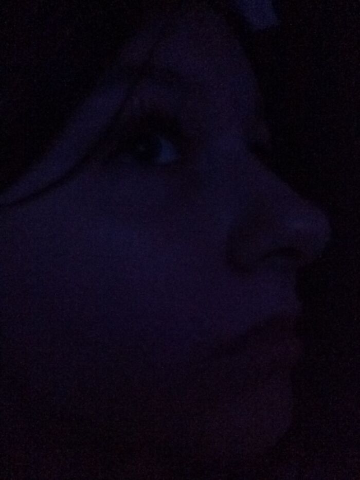 My Nose :/ Sorry For Dark Pic