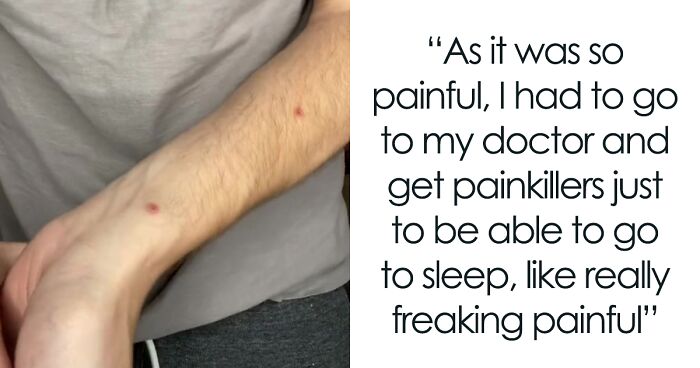 Monkeypox Is Starting To Spread More Widely And This Guy Shares What You Can Expect As He Went Through It Himself