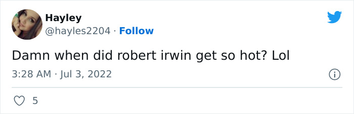 Robert Irwin's Photoshoot With Stellar Magazine Is Creating Quite A Buzz On The Internet Robert Irwin's Photoshoot With Stellar Magazine Is Creating Quite A Buzz On The Internet