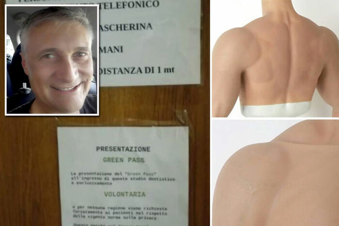 Un hombre italiano intentó usar un brazo falso para evitar que le dieran la vacuna contra la Covid y dijo que su vida “está arruinada”