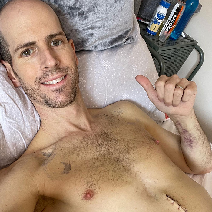 Dad Saved By Liver Transplant Shares Pictures Taken Before And After, Showing His Remarkable Recovery Dad Saved By Liver Transplant Shares Pictures Taken Before And After, Showing His Remarkable Recovery