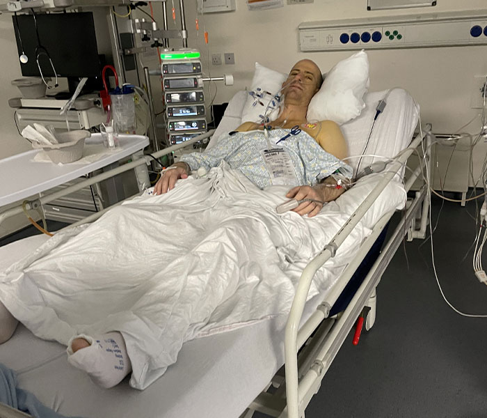 Dad Saved By Liver Transplant Shares Pictures Taken Before And After, Showing His Remarkable Recovery Dad Saved By Liver Transplant Shares Pictures Taken Before And After, Showing His Remarkable Recovery