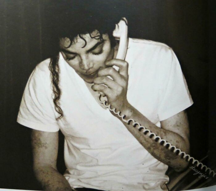 Una rara imagen que muestra el vitíligo de Michael Jackson