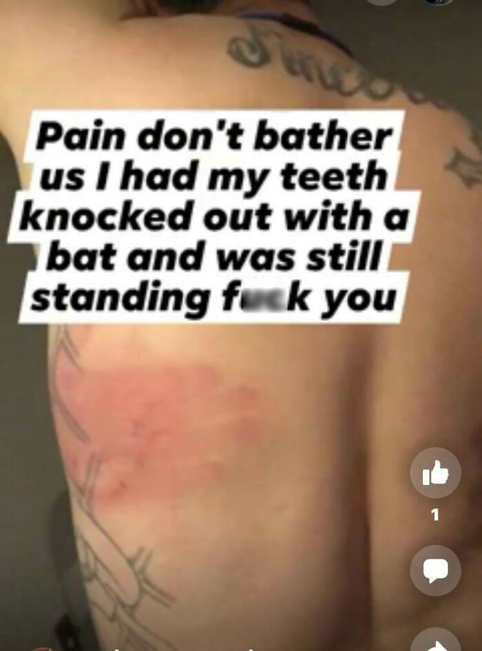 Pain Don’t Bather Us