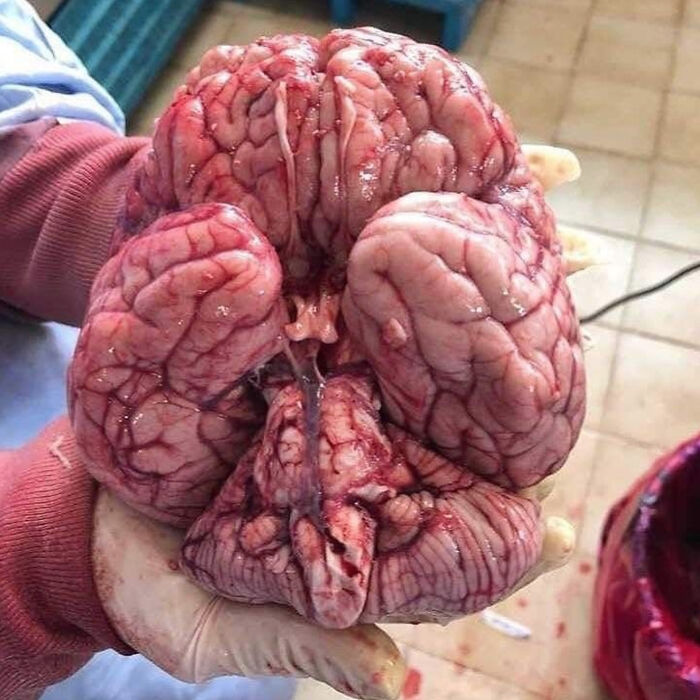 The Base Of The Brain Is A Masterpiece On Its Own!