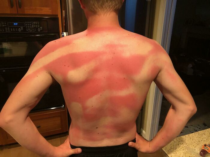 My Wife Helped Me Sunscreen My Back At Beach Day Today (Twice)