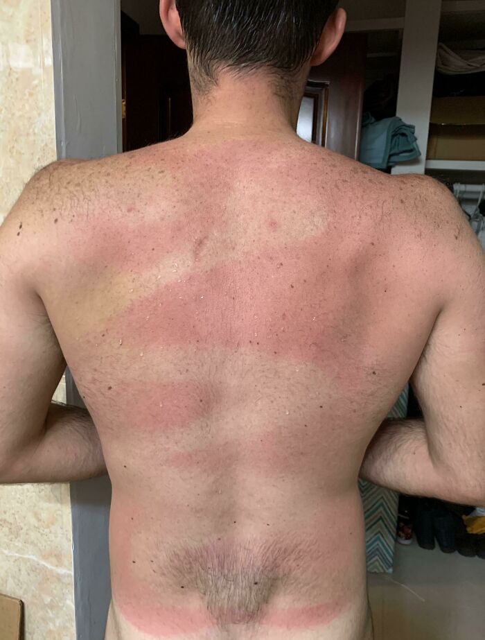 Wife Helped Spray Sunscreen On My Back