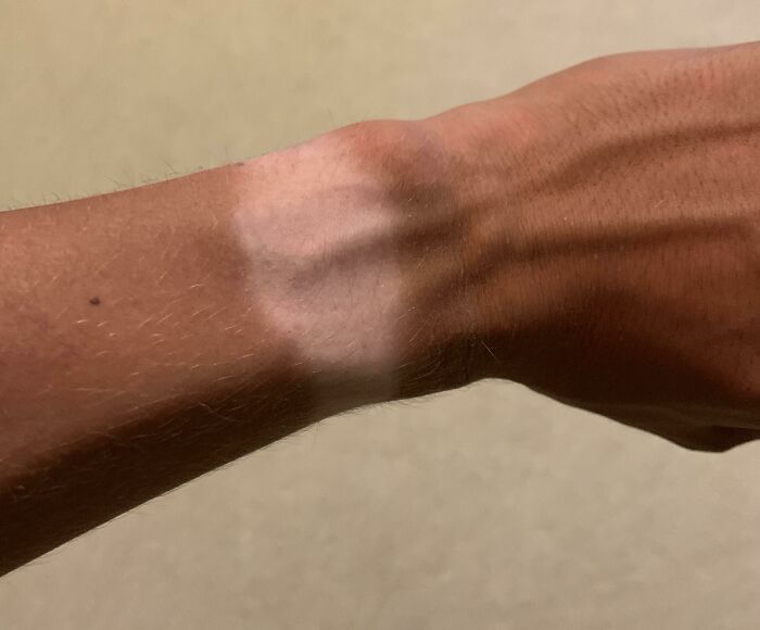My Watch Tan Is Coming Along Nicely