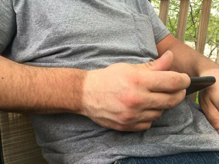 Tan Line On A Construction Worker Who Wears Gloves Daily