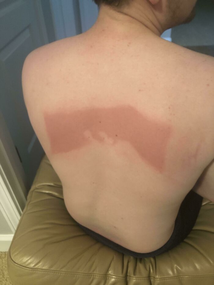 Sunscreen Is Very Effective, But I Can’t Reach The Middle Of My Back
