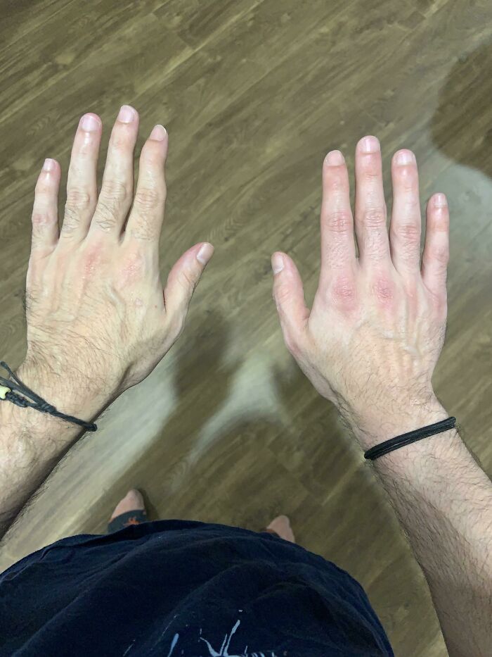 Each Of My Hands Are Different Size, Shape And Colour