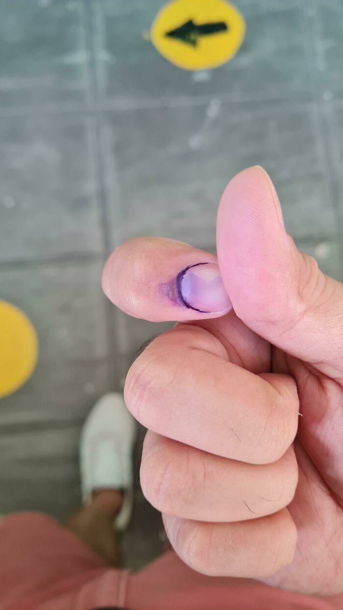 Te echan tinta indeleble en el dedo después de votar en Filipinas, para evitar que votes 2 veces