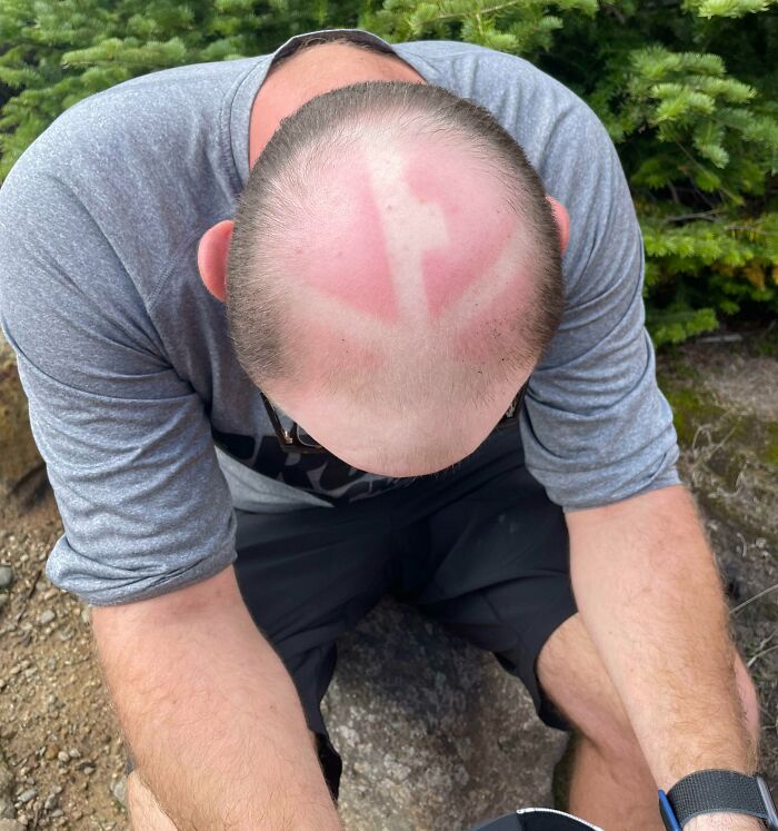 I Wore A Mesh Hat On A 30 Mile Hike. Feeling Like Aang Today