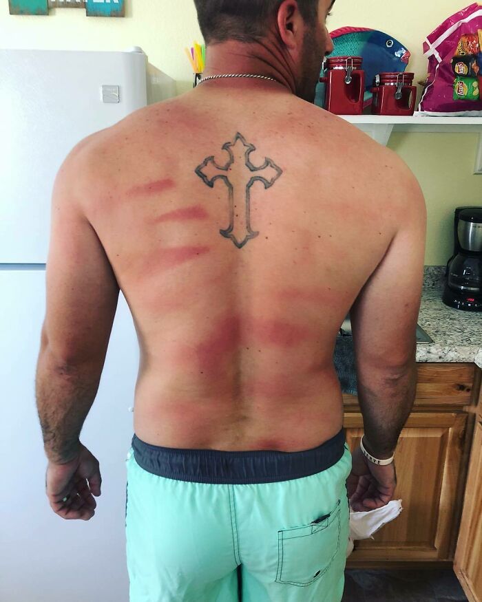 When You Don’t Rub In Your Husband's Sunscreen