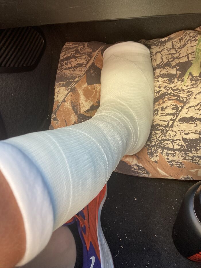 After Foot Surgery (Pic Taken A Couple Months Ago) I Can Finally Run After 6 Months!