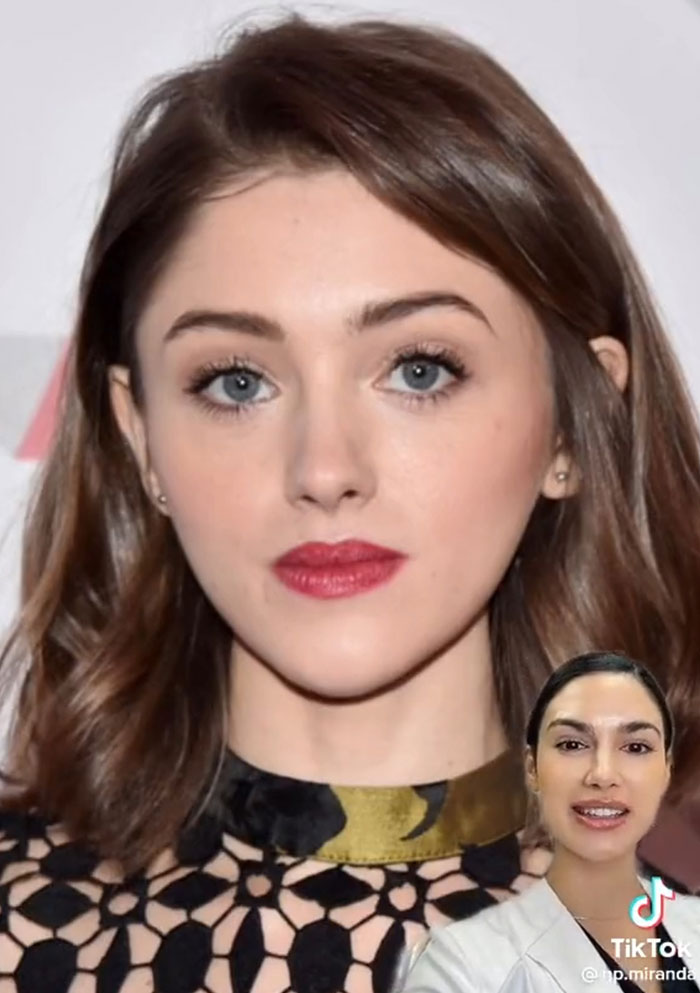 "This Is Why Everyone Looks The Same": People Slam This Nurse Injector For Giving Natalia Dyer A Face Transformation