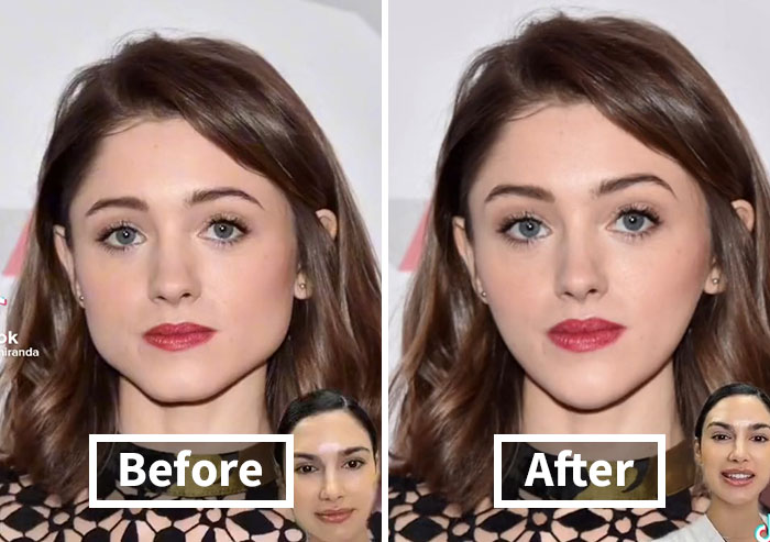 “This Is Why Everyone Looks The Same”: People Slam This Nurse Injector For Giving Natalia Dyer A Face Transformation