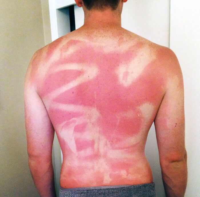 Last Summer When My Wife "Sprayed" Sunscreen All Over My Back