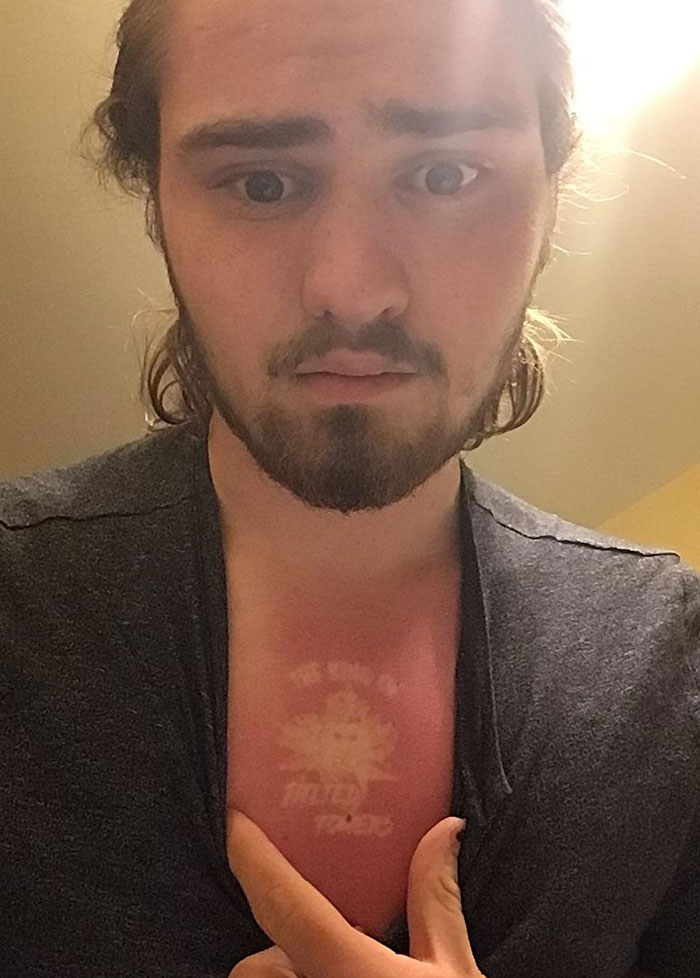 Me hice un tatuaje temporal, me quemé con el sol, y me quedó esta huella