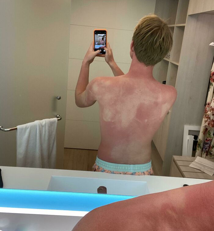 I Guess I’m Bad At Sunscreen