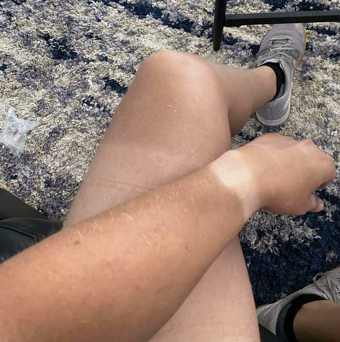 Who Else Has Some Crazy Tan Lines?