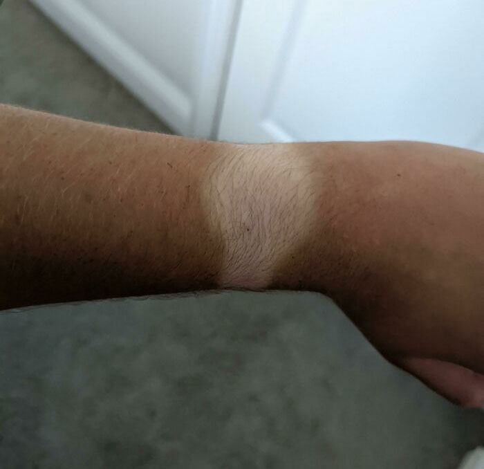 My Watch Tan Is Insane