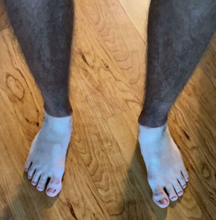 My Tan Lines Make Me Look Like I’m Wearing Necro-Pants