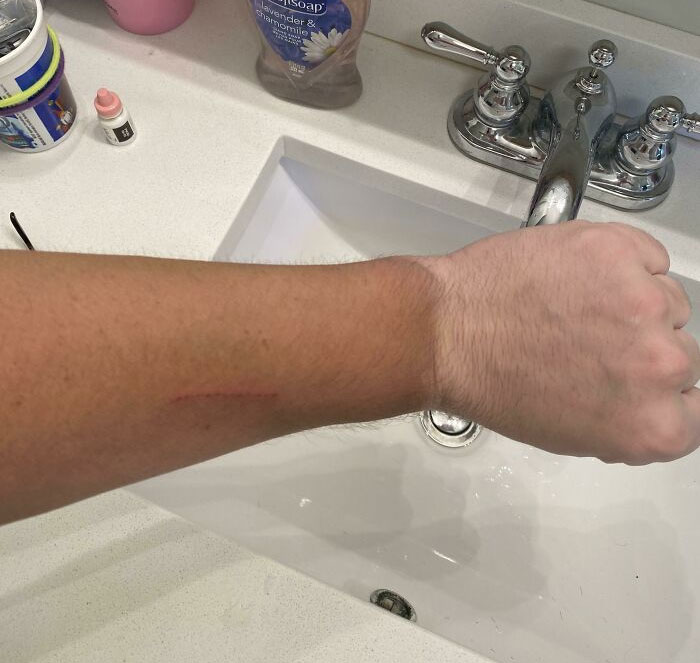 My Tan Line From Wearing Gloves At Work (Laborer On A Trash Truck)