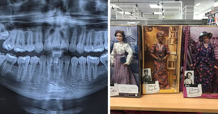 50 ‘Mildly Interesting’ Things You May Have Never Seen Before, As Shared In This Online Group (New Pics)