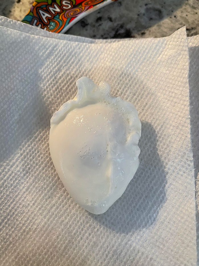 One Of The Eggs I Poached This Morning Came Out Looking Like A Human Heart