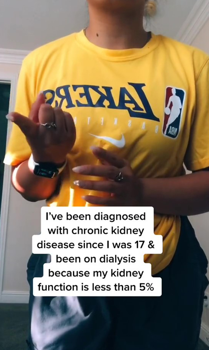 Guy Cheated On His Girlfriend After She Gave Him One Of Her Kidneys To Save His Life Guy Cheated On His Girlfriend After She Gave Him One Of Her Kidneys To Save His Life