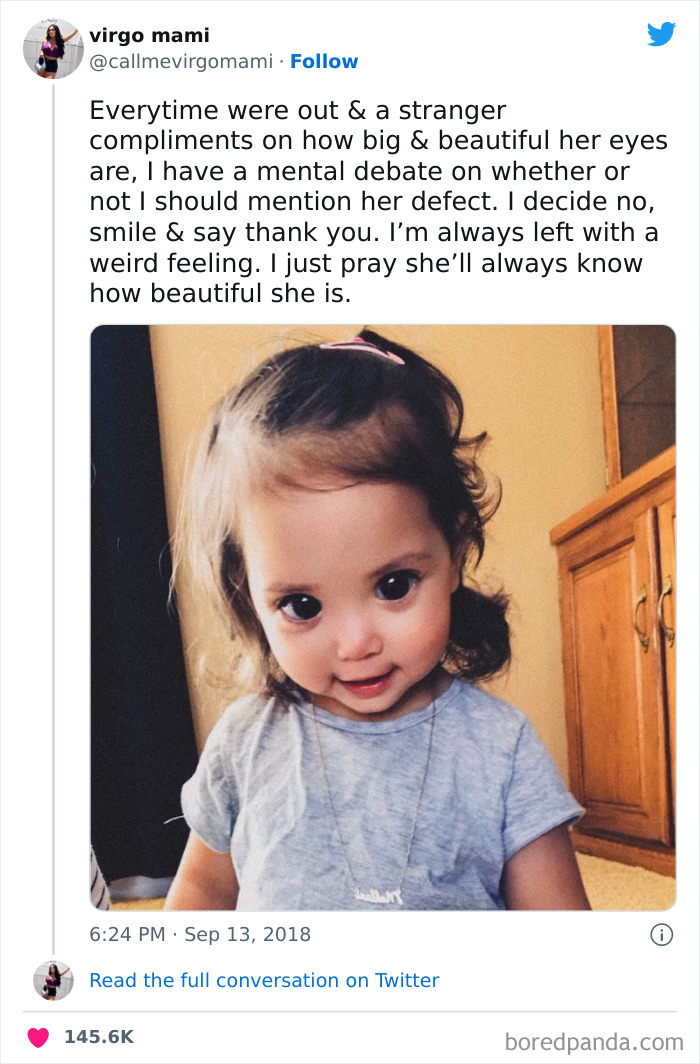 This Little Girl's Big, Beautiful Eyes Are Due To A Rare Genetic Syndrome Called Axenfeld-Rieger Syndrome