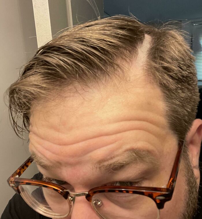Went To A New Barber. Asked For My Part To Be Cut In. She Mowed A 1/2” Stripe Out Of My Head