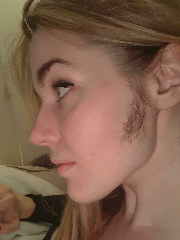 For A Cis Woman I Have Exceedingly Strong Sideburns