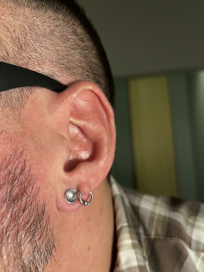 Was Born With Some Extra Skin On My Ear, So I Figured It Had To Be Done