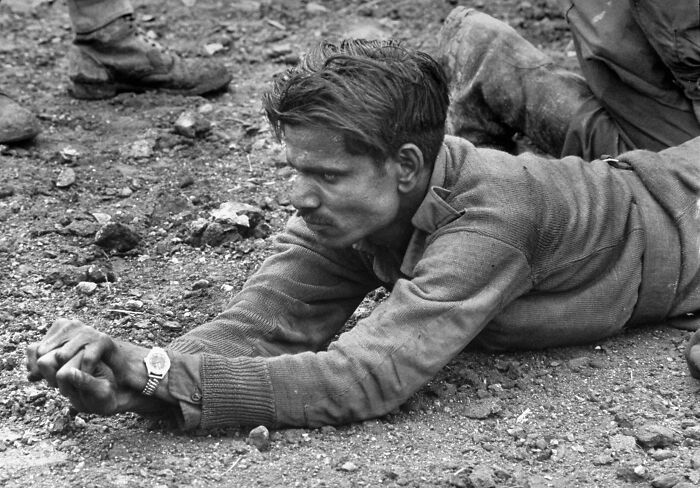 An Ambulance Driver From The Indian Army Clenches His Hands, Indicating The Intense Pain In His Leg Which Has Been Almost Completely Blown Off. Korean War (1951)