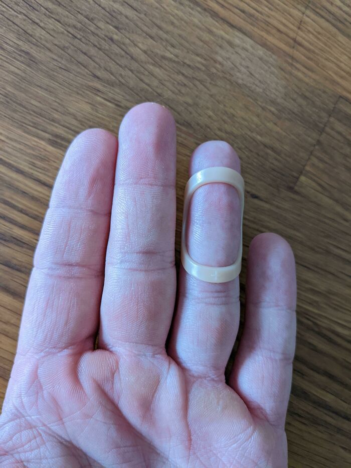 Starting To Lose The First Joint Crease On My Ring Finger After Being Splinted For 7 Weeks
