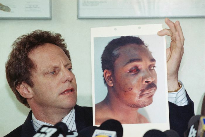 March 8, 1991. Steven Lerman, Attorney For Rodney King, Displays A Photo Of His Client During A Press Conference At His Office In Beverly Hills