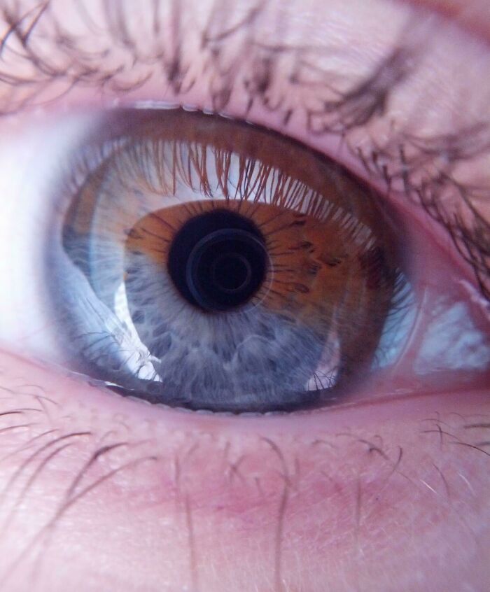Macro Shot Of My Blue And Brown Eye
