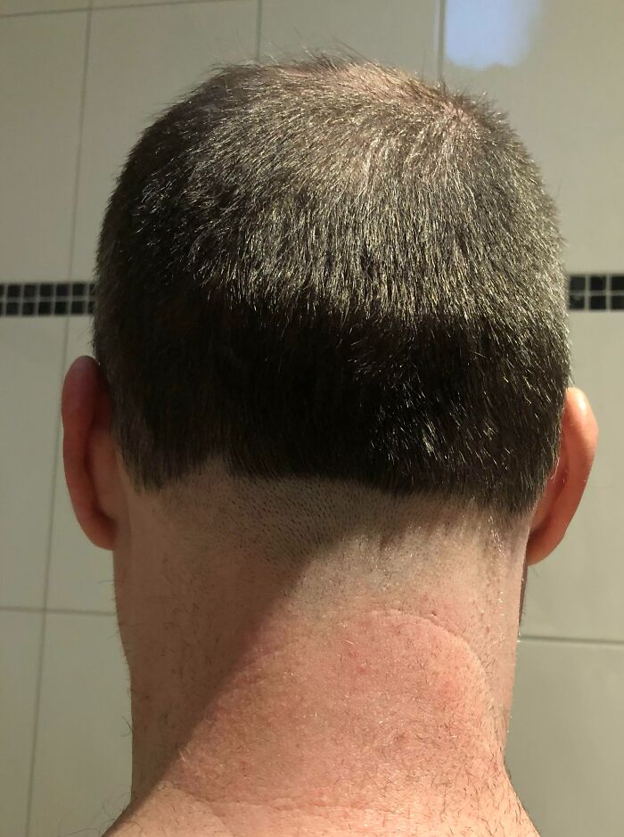 I Asked My Wife To Tidy Up My Neck With The Clippers.... Yes We Are Still Married