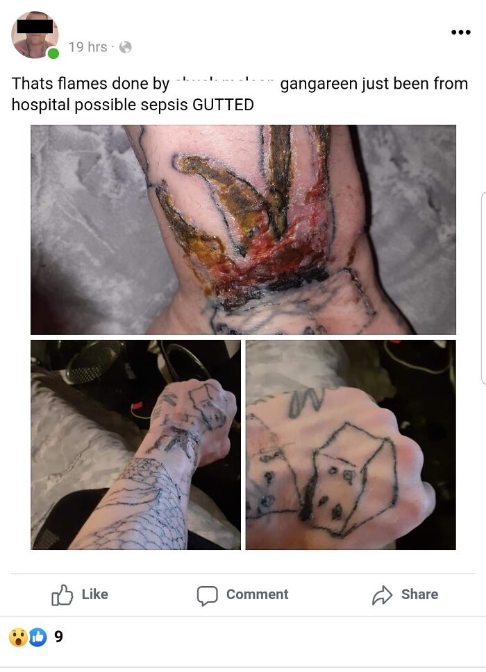 Sepsis Free With Every Tattoo