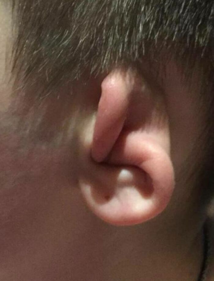 My Ear Can Do This