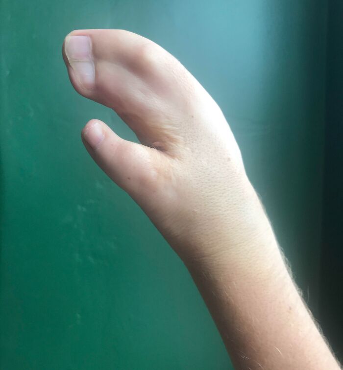 Here’s A Picture Of The Hand I Was Born With
