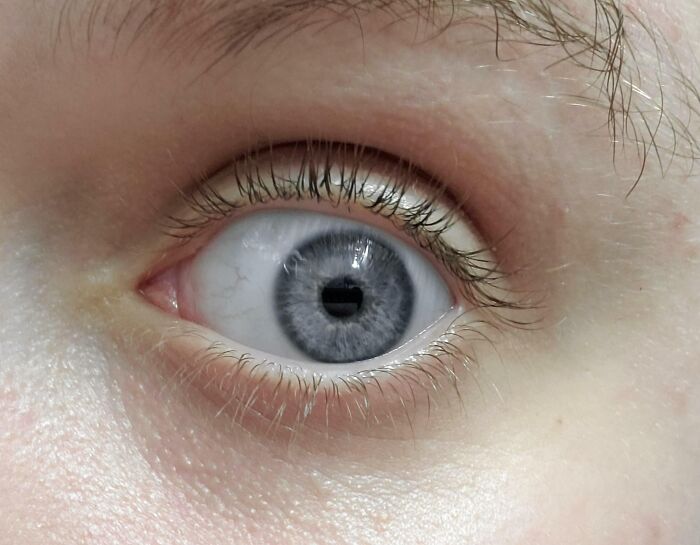 I Have Grey Eyes, I Had No Idea It Was So Rare Until Someone Mentioned It To Me